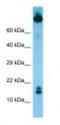 T-cell leukemia/lymphoma protein 1B antibody, NBP1-98534, Novus Biologicals, Western Blot image 