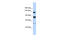 Transient receptor potential cation channel subfamily M member 4 antibody, ARP35268_P050, Aviva Systems Biology, Western Blot image 