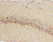 5-Hydroxytryptamine Receptor 1A antibody, LS-C312804, Lifespan Biosciences, Immunohistochemistry frozen image 