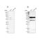 Carnitine O-Octanoyltransferase antibody, NBP1-85502, Novus Biologicals, Western Blot image 