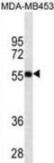 Vitamin D Receptor antibody, abx025462, Abbexa, Western Blot image 