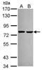 Acyl-CoA Synthetase Long Chain Family Member 3 antibody, PA5-29507, Invitrogen Antibodies, Western Blot image 