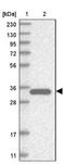 Estrogen sulfotransferase antibody, NBP1-84786, Novus Biologicals, Western Blot image 
