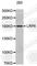 LDL Receptor Related Protein 6 antibody, A0596, ABclonal Technology, Western Blot image 