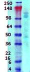 Gamma-Aminobutyric Acid Type B Receptor Subunit 1 antibody, orb67491, Biorbyt, Western Blot image 
