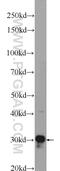 Translational Activator Of Cytochrome C Oxidase I antibody, 21147-1-AP, Proteintech Group, Western Blot image 