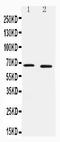Interleukin 1 Receptor Associated Kinase 3 antibody, PA2207-2, Boster Biological Technology, Western Blot image 