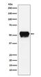 Fibrinogen Gamma Chain antibody, M00790-4, Boster Biological Technology, Western Blot image 