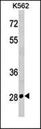 Ring Finger Protein 7 antibody, orb100014, Biorbyt, Western Blot image 