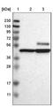 Calcium/calmodulin-dependent protein kinase type IV antibody, NBP1-88210, Novus Biologicals, Western Blot image 