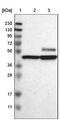 Calcium/Calmodulin Dependent Protein Kinase IV antibody, NBP1-88210, Novus Biologicals, Western Blot image 