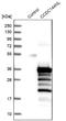 Coiled-Coil Domain Containing 144 Family, N-Terminal Like antibody, NBP2-14448, Novus Biologicals, Western Blot image 