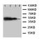 Toll Like Receptor Adaptor Molecule 1 antibody, LS-C313040, Lifespan Biosciences, Western Blot image 