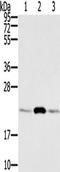 RAB9A, Member RAS Oncogene Family antibody, TA350320, Origene, Western Blot image 
