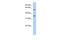 Thiamine transporter 2 antibody, PA5-42219, Invitrogen Antibodies, Western Blot image 