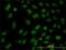 Forkhead Box R2 antibody, H00139628-M01, Novus Biologicals, Immunocytochemistry image 
