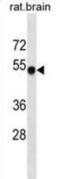 Calcium/Calmodulin Dependent Protein Kinase II Alpha antibody, abx025374, Abbexa, Western Blot image 