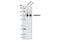 Gamma-Aminobutyric Acid Type B Receptor Subunit 2 antibody, 4819S, Cell Signaling Technology, Western Blot image 