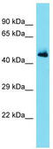 Serpin Family A Member 11 antibody, TA334832, Origene, Western Blot image 