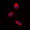 Mitogen-Activated Protein Kinase Kinase 3 antibody, orb315593, Biorbyt, Immunocytochemistry image 