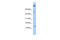 NOTCH Regulated Ankyrin Repeat Protein antibody, ARP56166_P050, Aviva Systems Biology, Western Blot image 