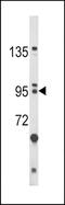 BicC Family RNA Binding Protein 1 antibody, TA324883, Origene, Western Blot image 