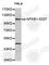 Nuclear Factor Kappa B Subunit 1 antibody, AP0125, ABclonal Technology, Western Blot image 