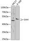 Sonic Hedgehog Signaling Molecule antibody, 23-134, ProSci, Western Blot image 