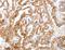 Aminoacylase 3 antibody, LS-C404439, Lifespan Biosciences, Immunohistochemistry paraffin image 