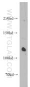 StAR Related Lipid Transfer Domain Containing 8 antibody, 13899-1-AP, Proteintech Group, Western Blot image 