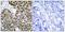 Heat Shock Transcription Factor 1 antibody, GTX50576, GeneTex, Immunohistochemistry paraffin image 
