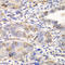 Glutamate-Cysteine Ligase Modifier Subunit antibody, LS-C333974, Lifespan Biosciences, Immunohistochemistry paraffin image 