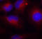 Phosphatase And Tensin Homolog antibody, STJ22352, St John