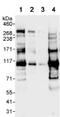 5'-3' Exoribonuclease 2 antibody, ab72181, Abcam, Western Blot image 