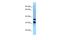 Phosphoglycolate Phosphatase antibody, A00932, Boster Biological Technology, Western Blot image 