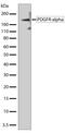 Platelet Derived Growth Factor Receptor Alpha antibody, 701142, Invitrogen Antibodies, Western Blot image 