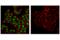 Double-stranded RNA-specific adenosine deaminase antibody, 81284S, Cell Signaling Technology, Immunofluorescence image 