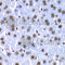 Splicing Factor 3b Subunit 2 antibody, A5875, ABclonal Technology, Immunohistochemistry paraffin image 
