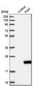 Fragile Histidine Triad Diadenosine Triphosphatase antibody, NBP1-89062, Novus Biologicals, Western Blot image 