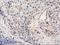 Pleckstrin Homology Domain Containing A3 antibody, LS-C172780, Lifespan Biosciences, Immunohistochemistry frozen image 