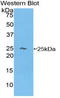 Hemoglobin Subunit Beta antibody, LS-C300914, Lifespan Biosciences, Western Blot image 