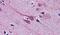 Gastrulation Brain Homeobox 2 antibody, PA5-18561, Invitrogen Antibodies, Immunohistochemistry frozen image 
