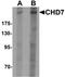 Chromodomain Helicase DNA Binding Protein 7 antibody, PA5-72690, Invitrogen Antibodies, Western Blot image 