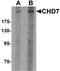 Chromodomain Helicase DNA Binding Protein 7 antibody, PA5-72690, Invitrogen Antibodies, Western Blot image 