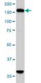 Kinesin Family Member 15 antibody, H00056992-M01, Novus Biologicals, Western Blot image 