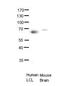 ETS Proto-Oncogene 2, Transcription Factor antibody, 31-278, ProSci, Enzyme Linked Immunosorbent Assay image 