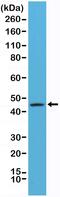 Keratin 20 antibody, MA5-27906, Invitrogen Antibodies, Western Blot image 