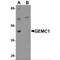 Geminin Coiled-Coil Domain Containing antibody, MBS150607, MyBioSource, Western Blot image 