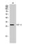 Fibroblast Growth Factor 13 antibody, STJ93061, St John