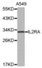 CD25 antibody, abx002170, Abbexa, Western Blot image 